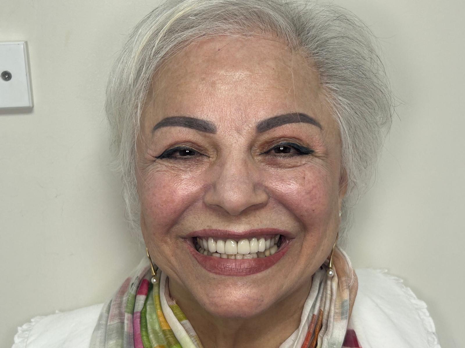 Patient's smile after treatment at Confident Smile Shepperton