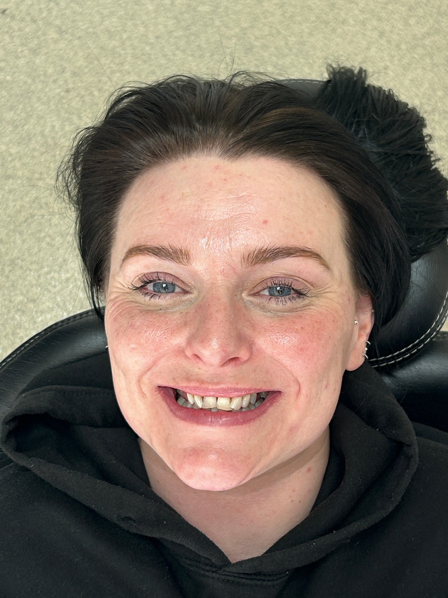 Patient's smile before treatment at Confident Smile Shepperton