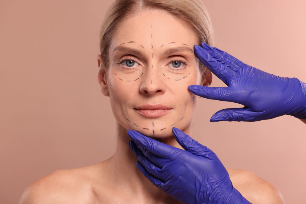 Anti-wrinkle treatment in Shepperton with facial assessment markings