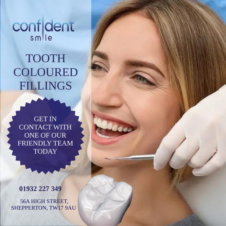 Dental fillings in Shepperton at Confident Smile Dental Practice
