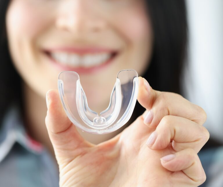 Custom-made mouthguards in Shepperton at Confident Smile Dental Practice