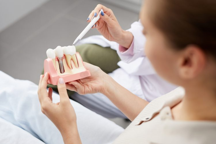 Dentist explaining dental implants in Shepperton using a tooth model