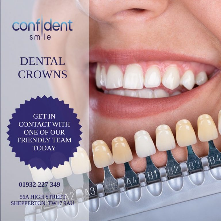 Dental crowns in Shepperton at Confident Smile Dental Practice