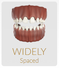 Widely Spaced Teeth