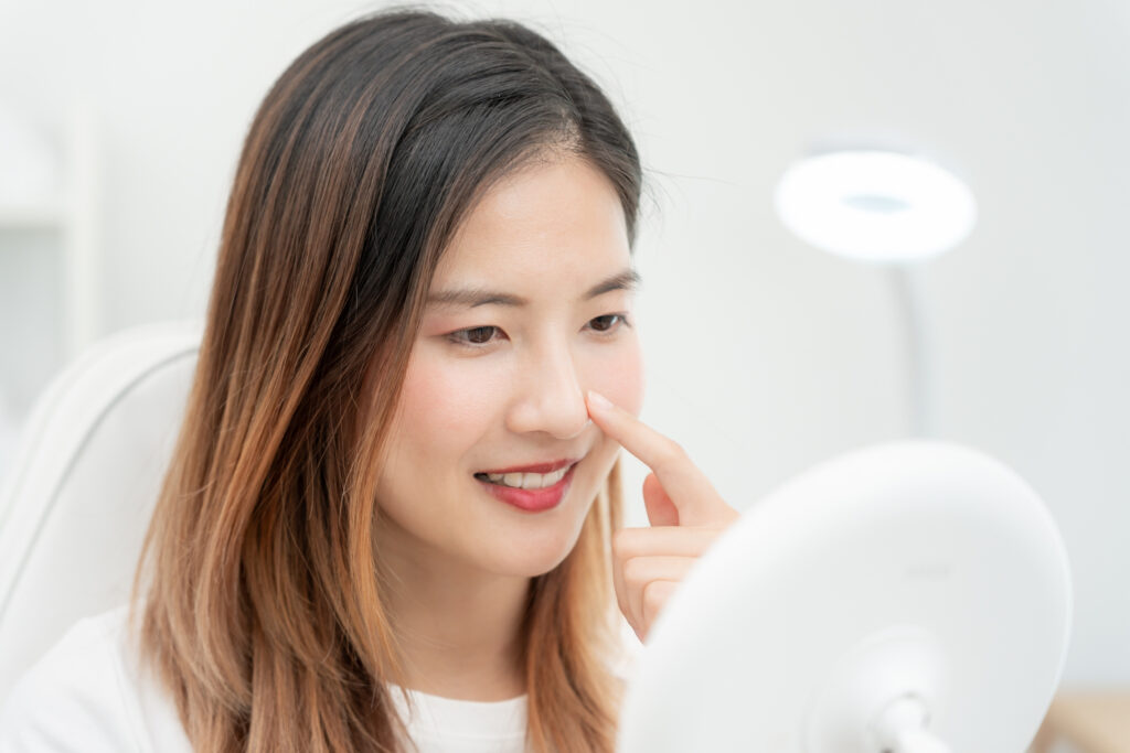 Skin boosters result — facial aesthetics in Shepperton