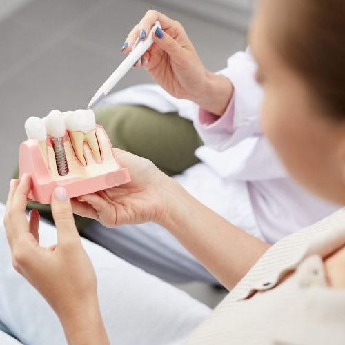 Dental Implants in Shepperton at Confident Smile