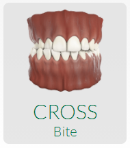 invisalign for cross bite forest hill